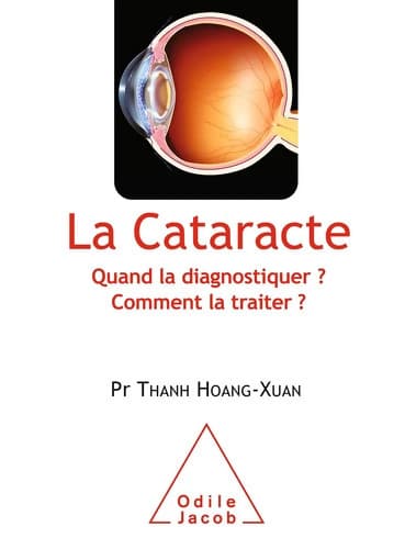 La Cataracte : Quand la diagnostiquer ? Comment la traiter ? - Thanh Hoang-Xuan